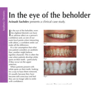 In the eye of the beholder