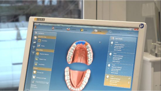 The reasons your practice needs a digital scanner