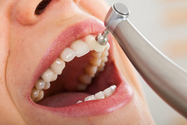 why-is-it-important-to-see-a-dental-hygienist-enlighten-smiles-blog